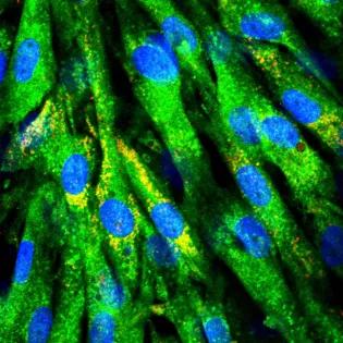 A brightly coloured microscopic image shows yellow-stained proteins.