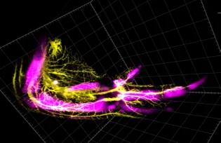 In Situ Hybridisation of a chick embryo Wing to Look at Bones (magenta) and Nerve (yellow)
