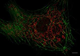 Zeiss Elyra 7 with Lattice SIM²
