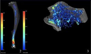 2.Quantification of osmium stained adipocytes in CKD mouse bone. 3.Quantification of trabecular bone in proximal region of mouse tibial bone.