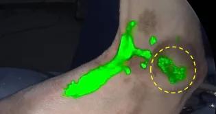 dogs leg with lymphatic system highlighted by flourescent green dye