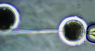 Microinjection as viewed through a microscope