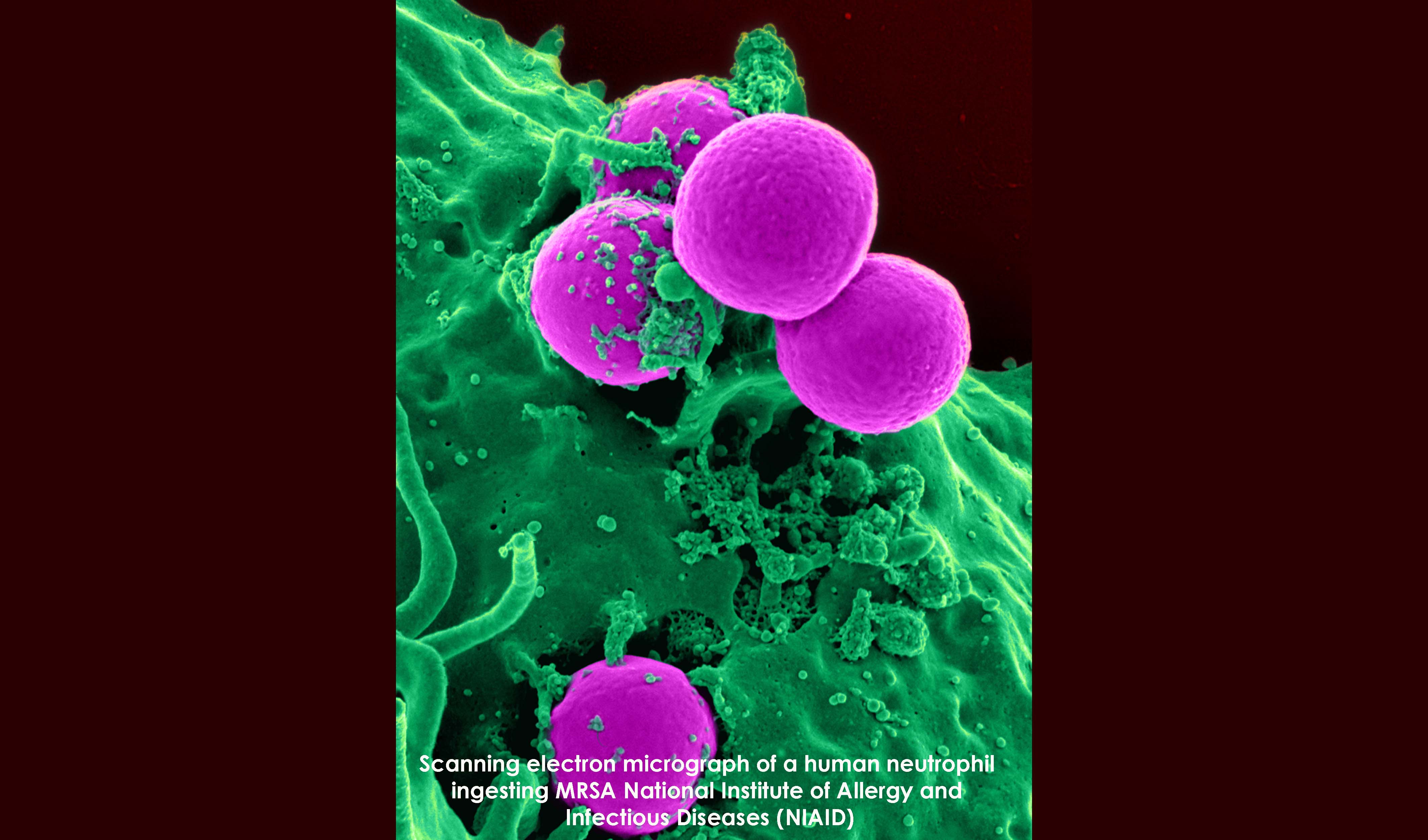 Scanning electron micrograph of a human neurtrophil ingesting MRSA - National Institute of Allergy and Infectious Diseases (NIAID)