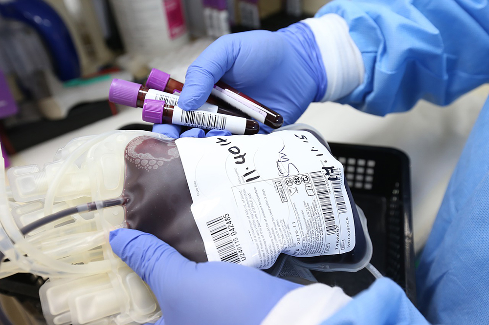 Medical professional holding bag and tubes containing blood for donation