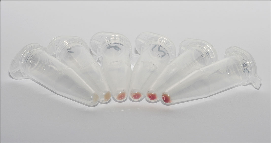 Lab tubes each containing blood, in a gradient that turns from yellow to red, demonstrating red blood cell formation.