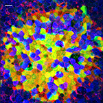 CSF1R-eGFP transgene expression highlights lymphoid structures