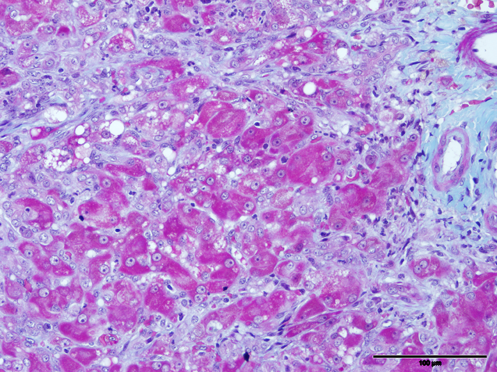 Presence of Systemic Inflammatory Response Syndrome Predicts a Poor Clinical Outcome in Dogs with a Primary Hepatitis