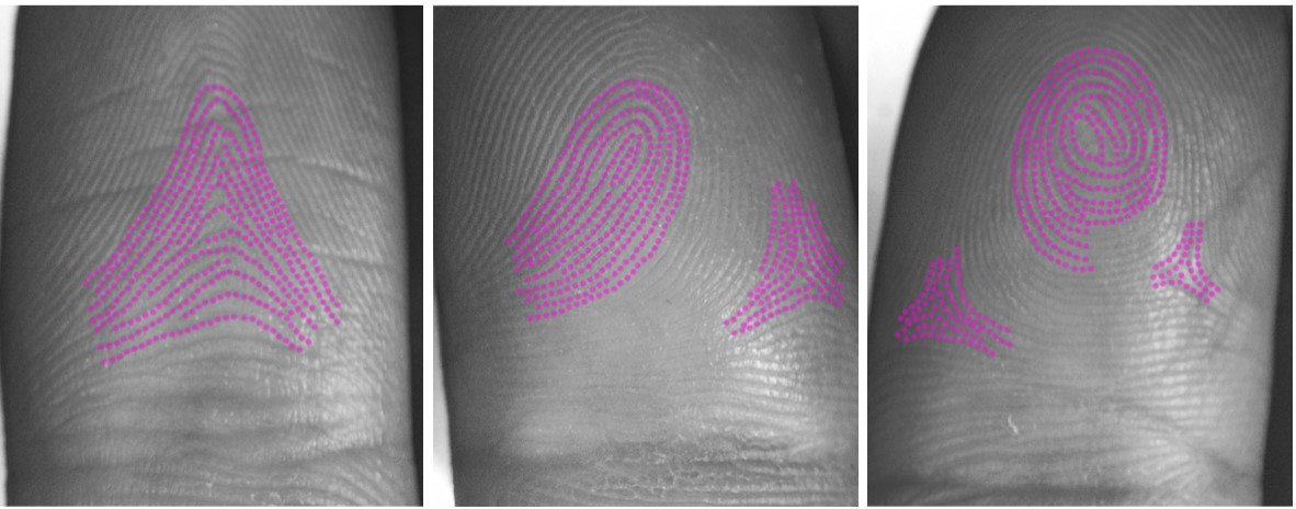 Gene activity and digit structure define fingerprint pattern | The ...