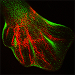 HH32 stage limb bud from the CSF1R-eGFP reporter chicken