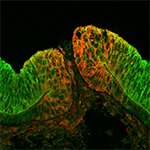 Expression of Optic Fissure Margin (OFM) gene