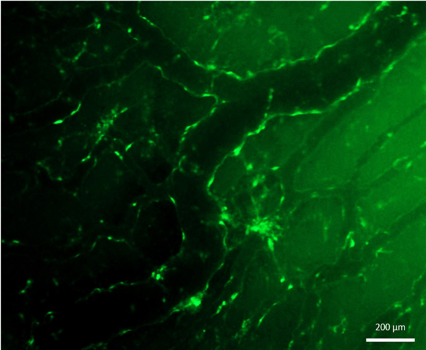 Split GFP