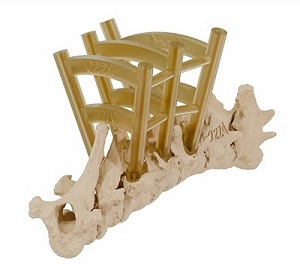 3D-printed drill guide sitting on a 3D-printed vertebral column