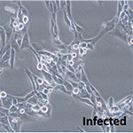 Cytomegalovirus