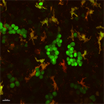 Multiple transgenes highlight different immune cell populations