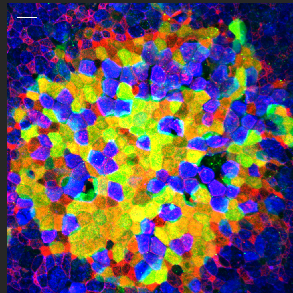 Surface view of the bursal mucosa with fluorescent proteins expressing M-cells.